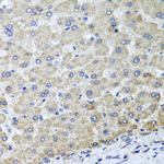 OSGEPL1 Polyclonal Antibody