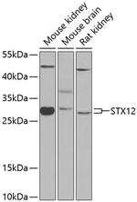 STX12 Polyclonal Antibody