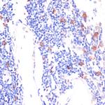 WNT5B Antibody in Immunohistochemistry (Paraffin) (IHC (P))