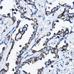 MSRB2 Polyclonal Antibody