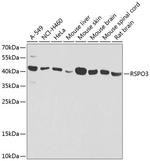 RSPO3 Polyclonal Antibody