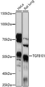 HIC5 Polyclonal Antibody