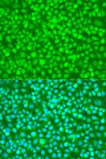 N4BP1 Polyclonal Antibody