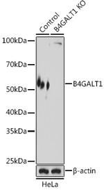 B4GALT1 Polyclonal Antibody