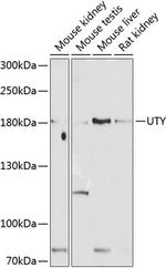 UTY Polyclonal Antibody