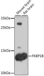 FKBP1B Polyclonal Antibody