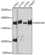 NUP160 Polyclonal Antibody