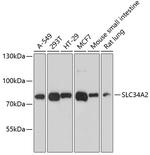SLC34A2 Polyclonal Antibody