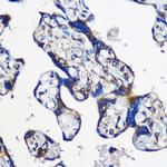 EYA1 Polyclonal Antibody
