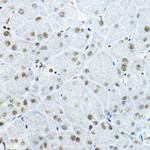 GATAD2B Polyclonal Antibody