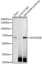 GATAD2B Antibody in Immunoprecipitation (IP)