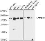 GATAD2B Antibody in Western Blot (WB)