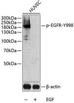 Phospho-EGFR (Tyr998) Antibody in Western Blot (WB)