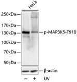 Phospho-ASK1 (Thr918) Antibody in Western Blot (WB)