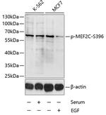 Phospho-MEF2C (Ser396) Antibody in Western Blot (WB)