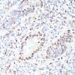 Phospho-c-Myc (Ser62) Polyclonal Antibody
