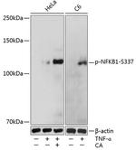 Phospho-NFkB p105/p50 (Ser337) Polyclonal Antibody