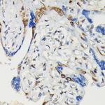 Phospho-VASP (Ser239) Antibody in Immunohistochemistry (Paraffin) (IHC (P))
