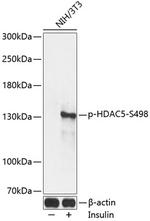 Phospho-HDAC5 (Ser498) Polyclonal Antibody