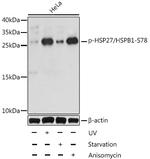 Phospho-HSP27 (Ser78) Antibody in Western Blot (WB)