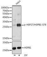 Phospho-HSP27 (Ser78) Antibody in Western Blot (WB)