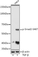 Phospho-SMAD2 (Ser465, Ser467) Polyclonal Antibody
