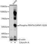 Phospho-PRMT4 (Ser228) Polyclonal Antibody
