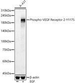 Phospho-VEGF Receptor 2 (Tyr1175) Polyclonal Antibody