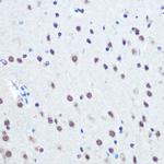 Phospho-Rb (Ser780) Polyclonal Antibody