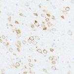 Phospho-S6 (Ser240, Ser244) Antibody in Immunohistochemistry (Paraffin) (IHC (P))