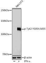 Phospho-TYK2 (Tyr1054, Tyr1055) Polyclonal Antibody