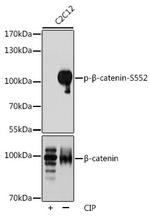 Phospho-beta Catenin (Ser552) Antibody in Western Blot (WB)