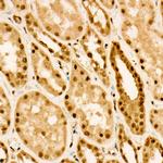 Phospho-FOXO3A (Ser253) Polyclonal Antibody