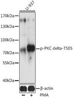 Phospho-PKC delta (Thr505) Antibody in Western Blot (WB)
