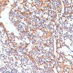 Phospho-Vimentin (Ser39) Antibody in Immunohistochemistry (Paraffin) (IHC (P))