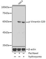 Phospho-Vimentin (Ser39) Antibody in Western Blot (WB)