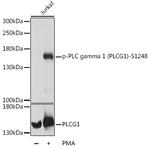 Phospho-PLCG1 (Ser1248) Antibody in Western Blot (WB)