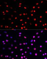 Phospho-Histone H3 (Thr45) Antibody in Immunocytochemistry (ICC/IF)