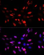 Phospho-Histone H3 (Thr45) Antibody in Immunocytochemistry (ICC/IF)