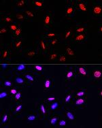 Phospho-Histone H3 (Thr45) Antibody in Immunocytochemistry (ICC/IF)