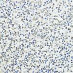 Phospho-Histone H3 (Thr45) Antibody in Immunohistochemistry (Paraffin) (IHC (P))