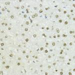 Phospho-Histone H3 (Thr45) Antibody in Immunohistochemistry (Paraffin) (IHC (P))