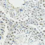 Phospho-Histone H3 (Thr45) Antibody in Immunohistochemistry (Paraffin) (IHC (P))