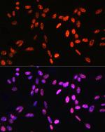 Phospho-Histone H3 (Thr6) Antibody in Immunocytochemistry (ICC/IF)