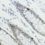 Phospho-Histone H3 (Thr6) Antibody in Immunohistochemistry (Paraffin) (IHC (P))