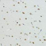 Phospho-Histone H3 (Thr6) Antibody in Immunohistochemistry (Paraffin) (IHC (P))