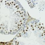 Phospho-Histone H3 (Thr6) Antibody in Immunohistochemistry (Paraffin) (IHC (P))