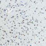 Phospho-Histone H3 (Thr6) Antibody in Immunohistochemistry (Paraffin) (IHC (P))