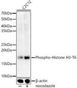 Phospho-Histone H3 (Thr6) Antibody in Western Blot (WB)