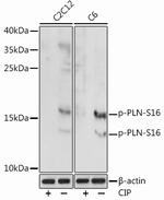 Phospho-Phospholamban (Ser16) Polyclonal Antibody